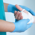 The Benefits Of Functional Medicine For Hand Fractures Recovery With The Help Of Atlanta Hand Specialists